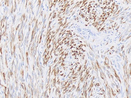 3255B | Control Slides:Immunopathology; Desmin